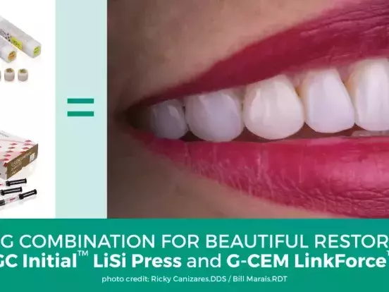 G-CEM LinkForce® and GC Initial™ LiSi Press