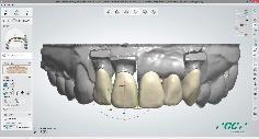 SOFTWARE Dental Designer