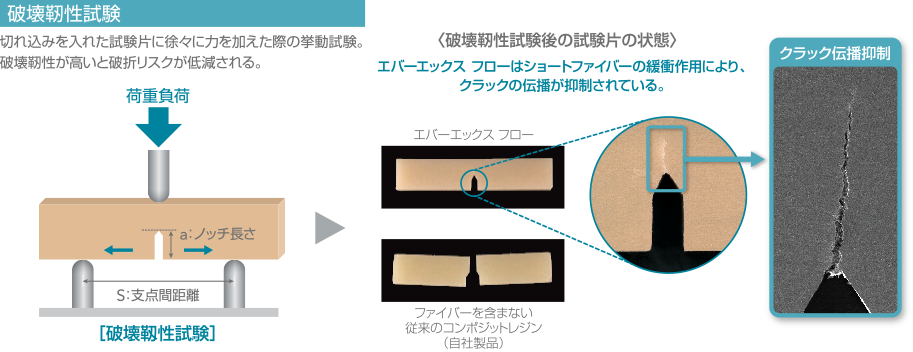 歯質や材料自体の破折リスクを低減