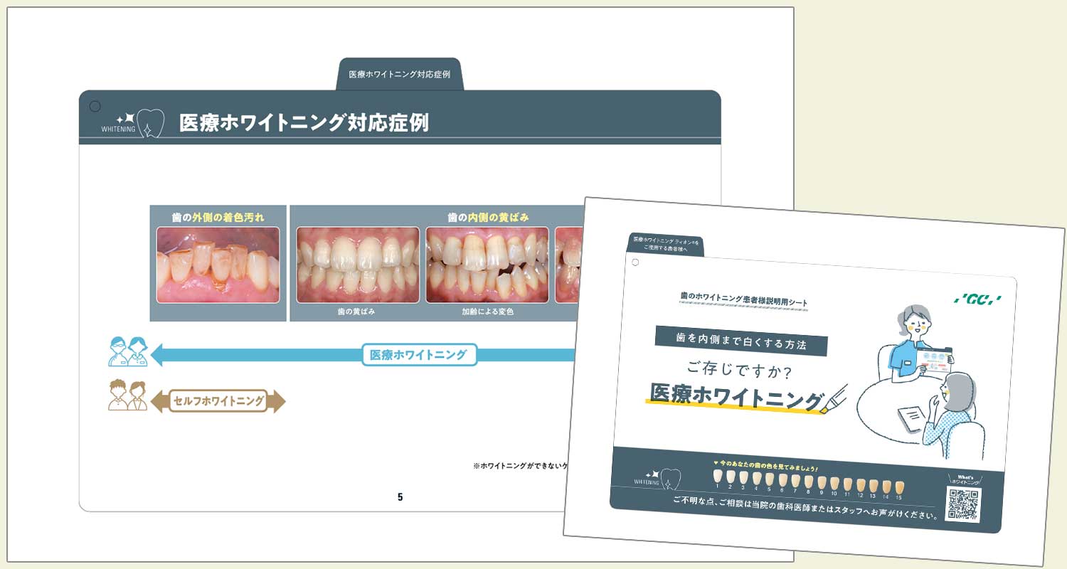 ご存じですか？医療ホワイトニング