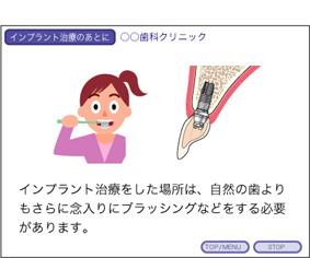 デンタルIQさん 〈インプラント編〉 〈パソコン用ソフトfor Windows