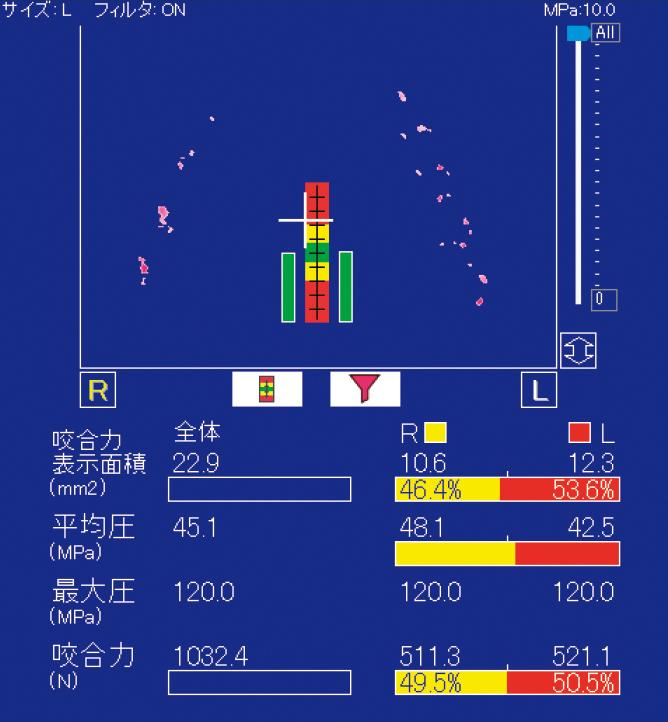 DENTALPRESCALE | 株式会社ジーシー